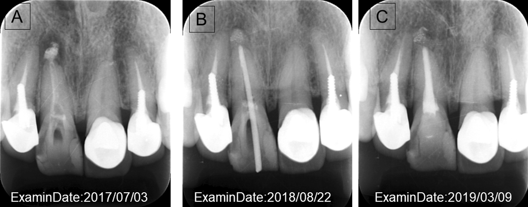 Fig. 5