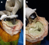 Fig. 3