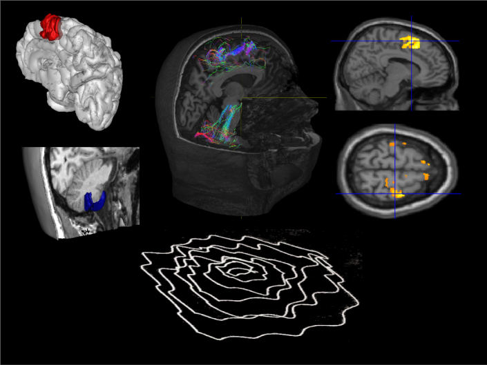 graphic file with name awv171fig1g.jpg