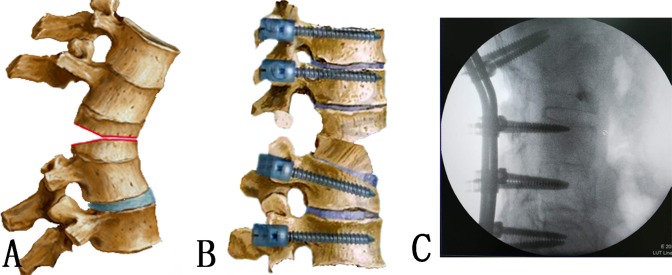 Fig 3