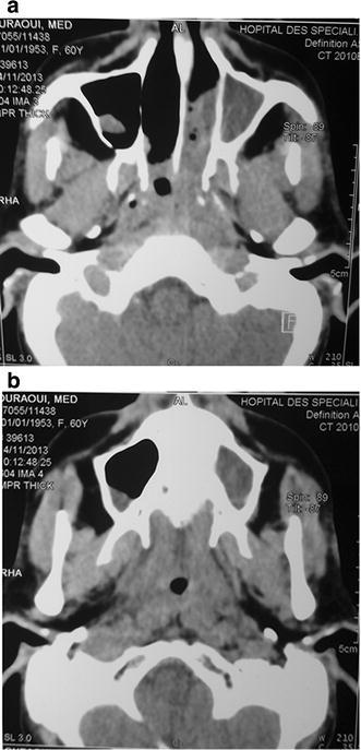 Fig. 1