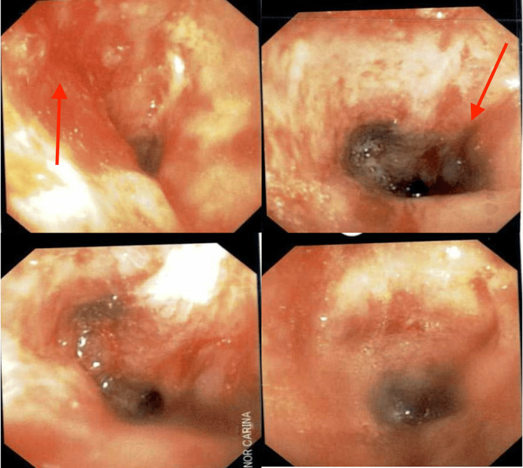 Figure 10