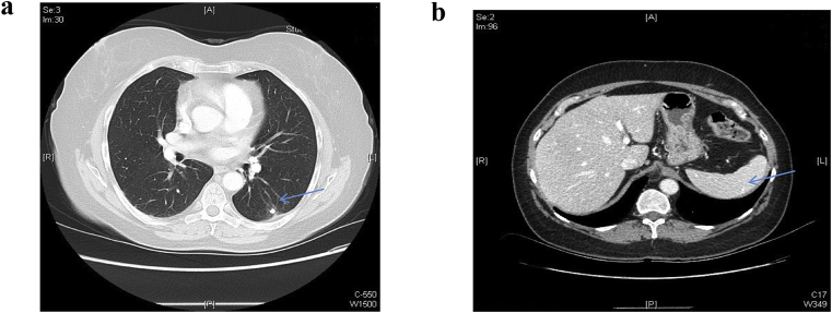 Fig. 4