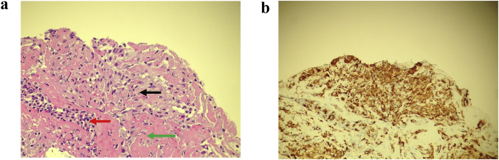 Fig. 3