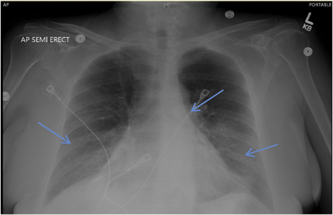 Fig. 1