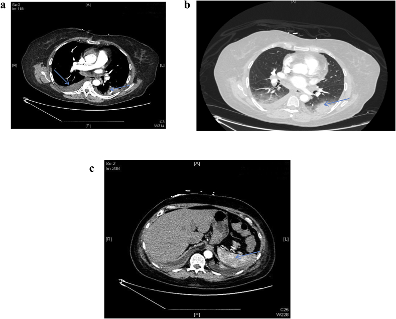 Fig. 2