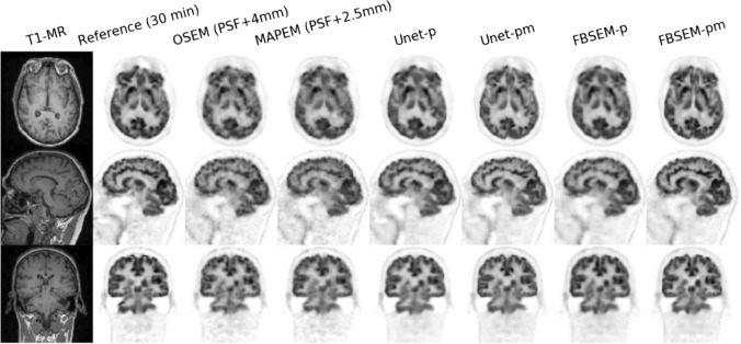 Fig. 18