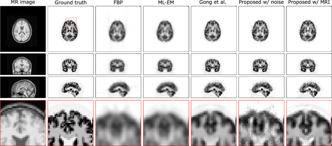 Fig. 16