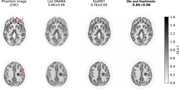 Fig. 12