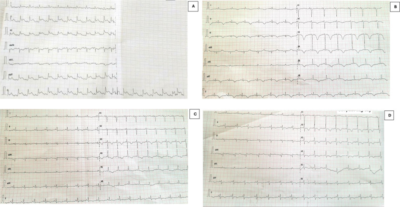 Fig. 1