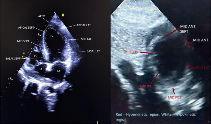 Fig. 2