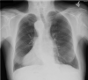 Fig 1