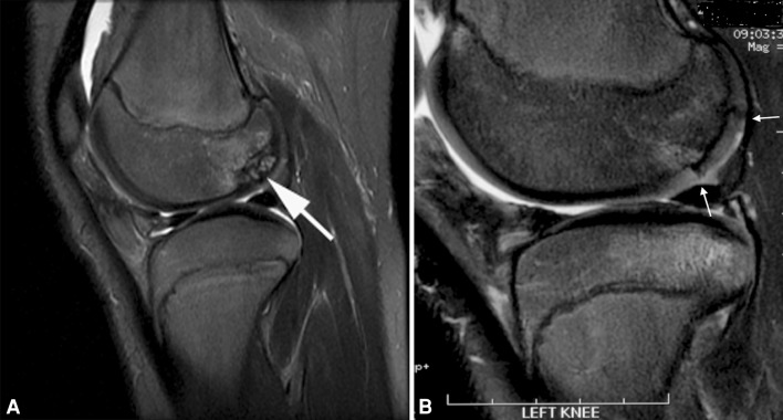 Fig. 2A–B