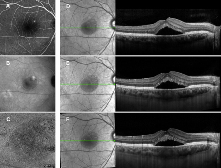 Fig. 2