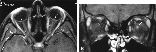 Fig 3.