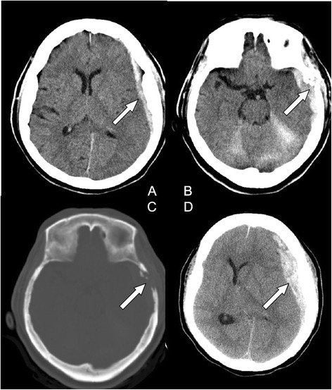 Fig. 1