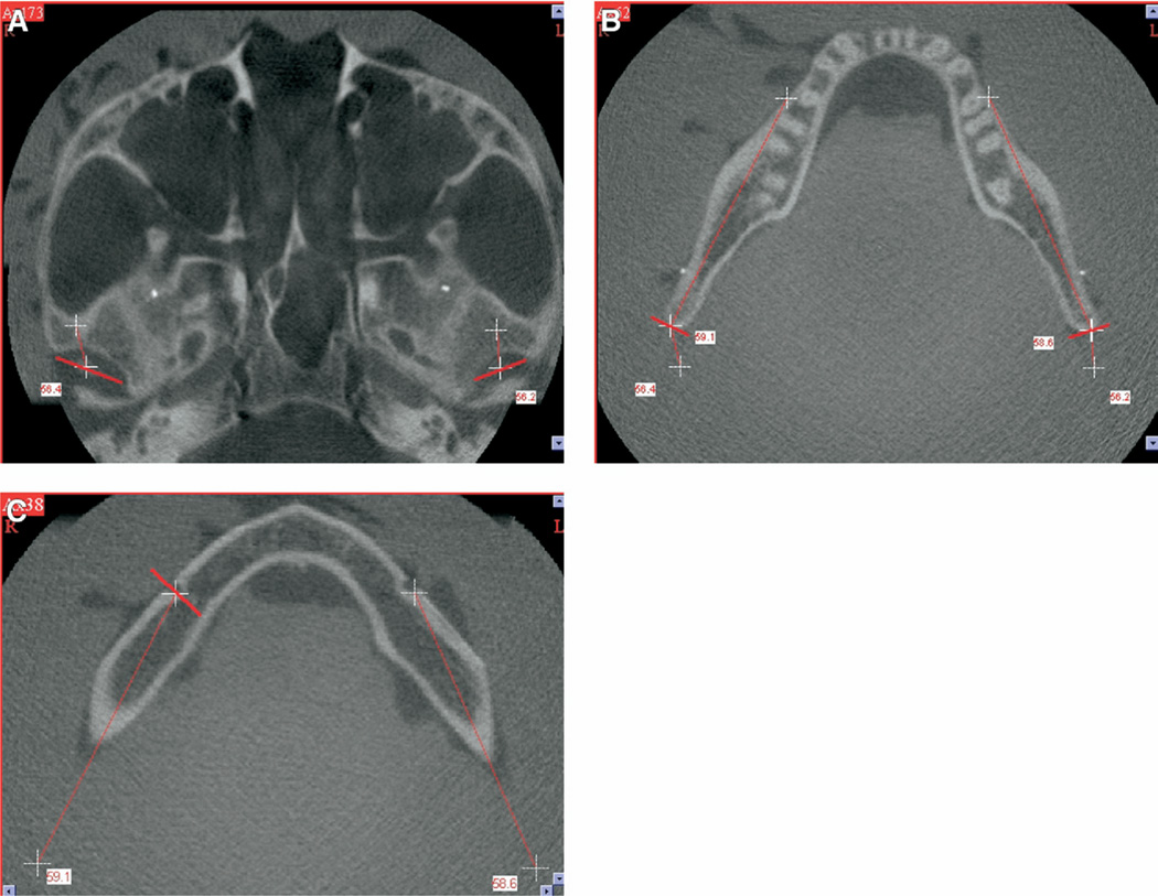 Fig. 3