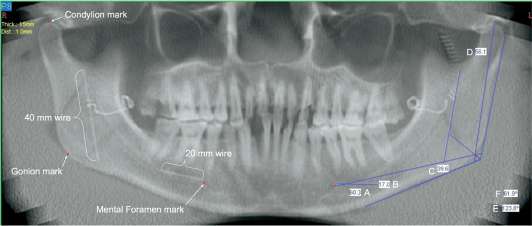 Fig. 2