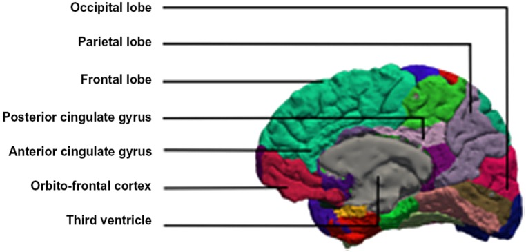 FIGURE 1