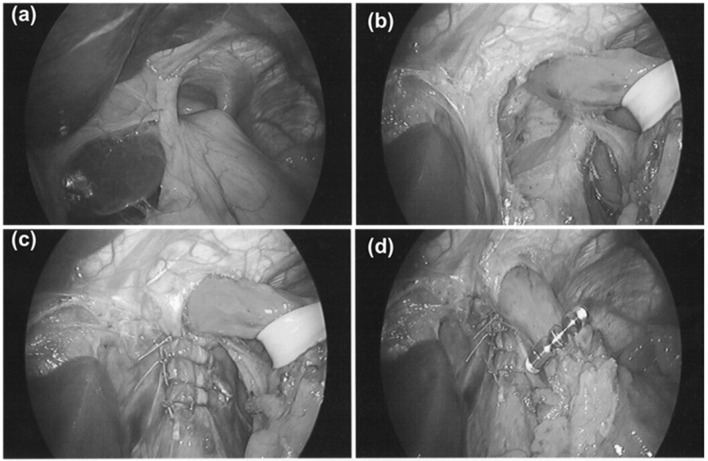 Fig. 1