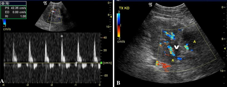 Fig. 2