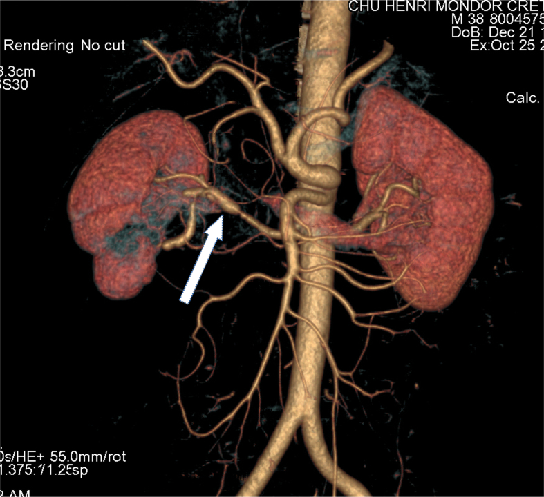 Unlabelled Image