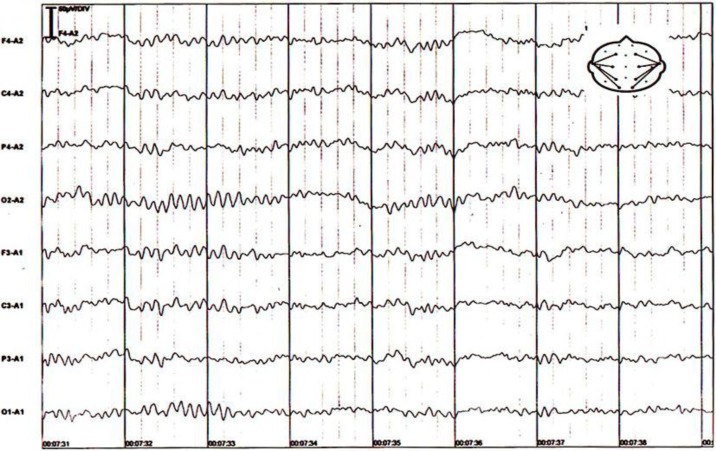 Fig. 4