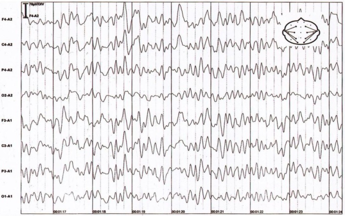 Fig. 1