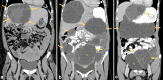 Fig. 5