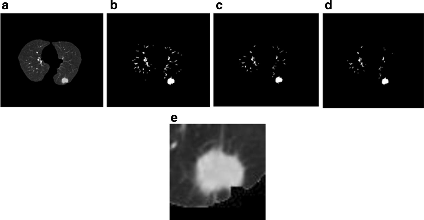 Fig. 2