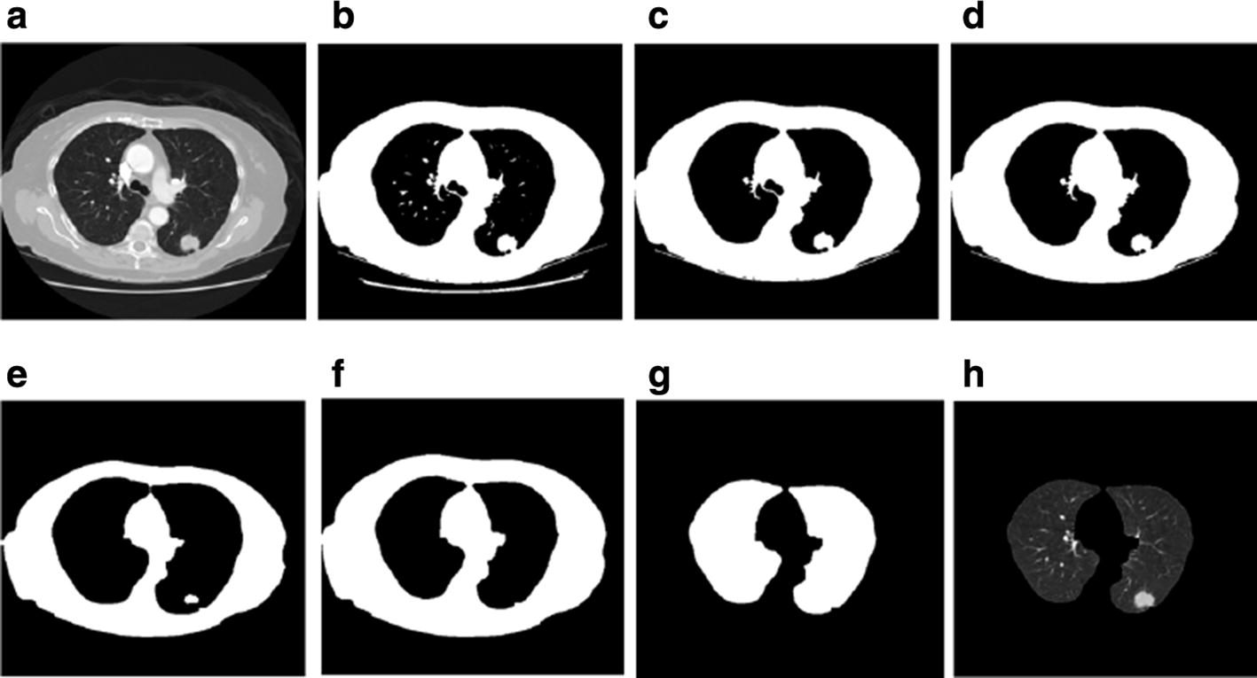 Fig. 1