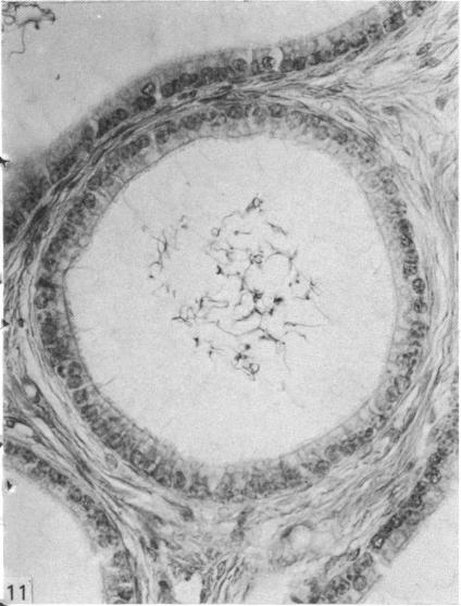 Fig. 11