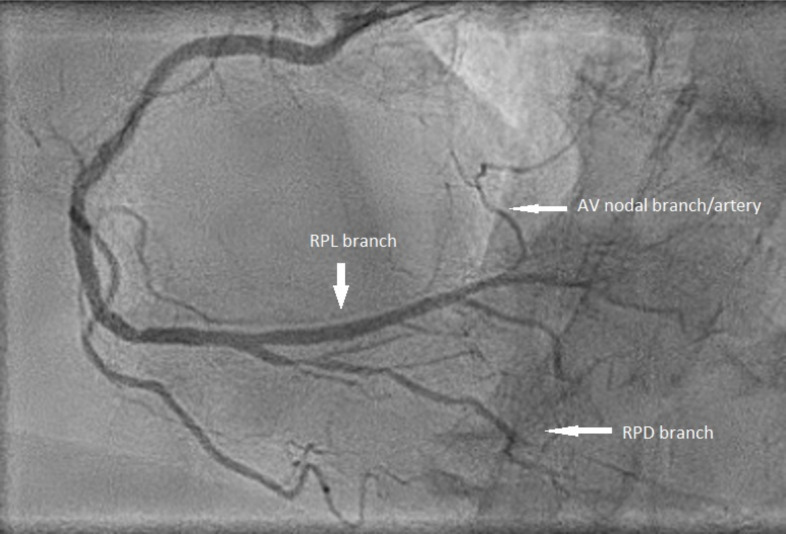 Fig. (2)