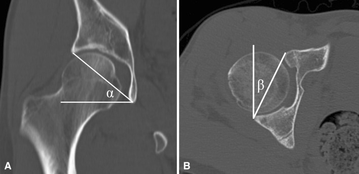 Fig. 3A–B