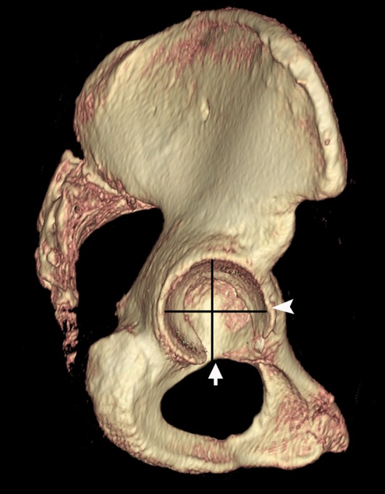 Fig. 2