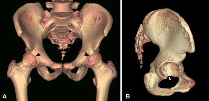 Fig. 1A–B