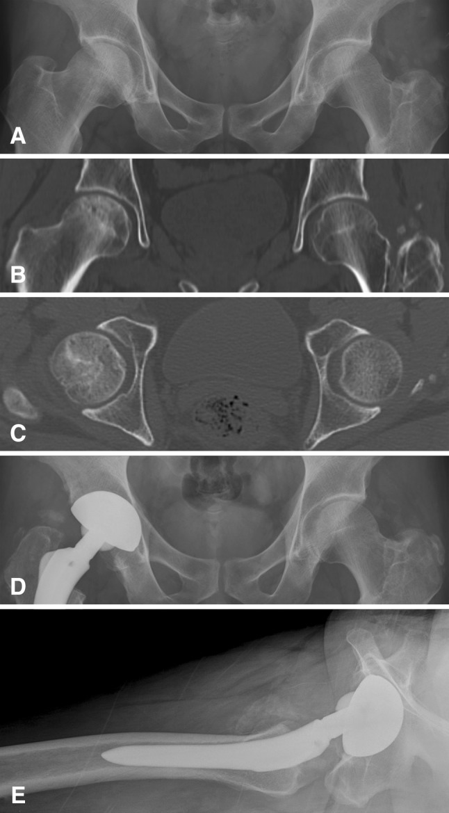 Fig. 7A–E