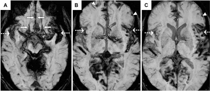 Fig. 2