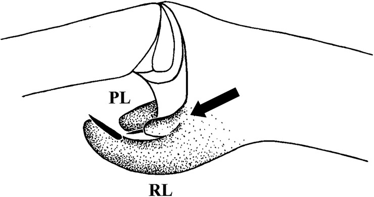 Fig 16