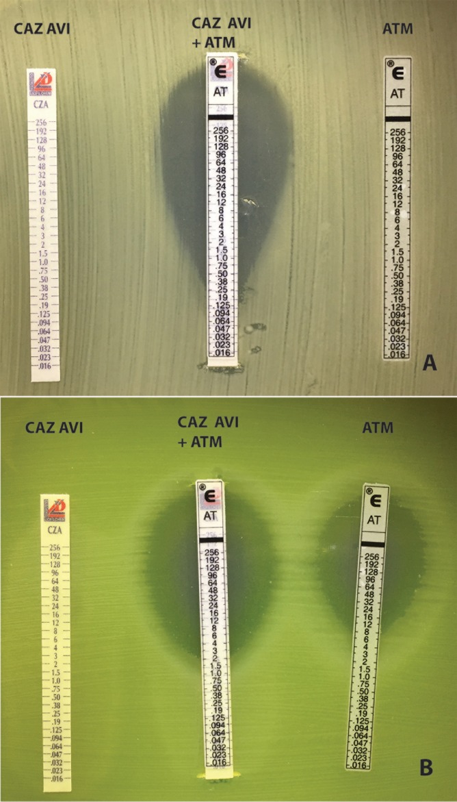 FIG 1