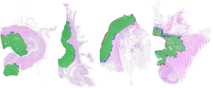 Fig. 12