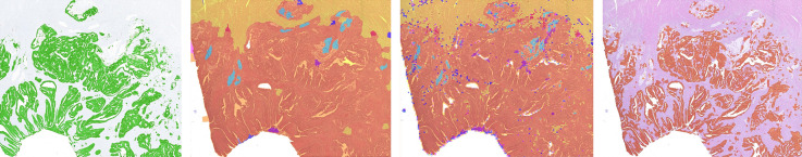 Fig. 17