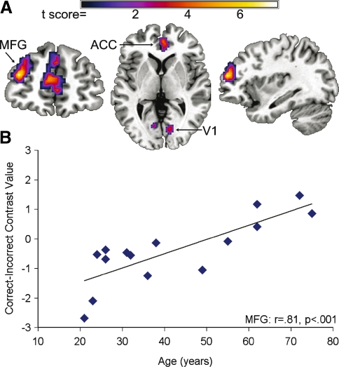 FIG. 4