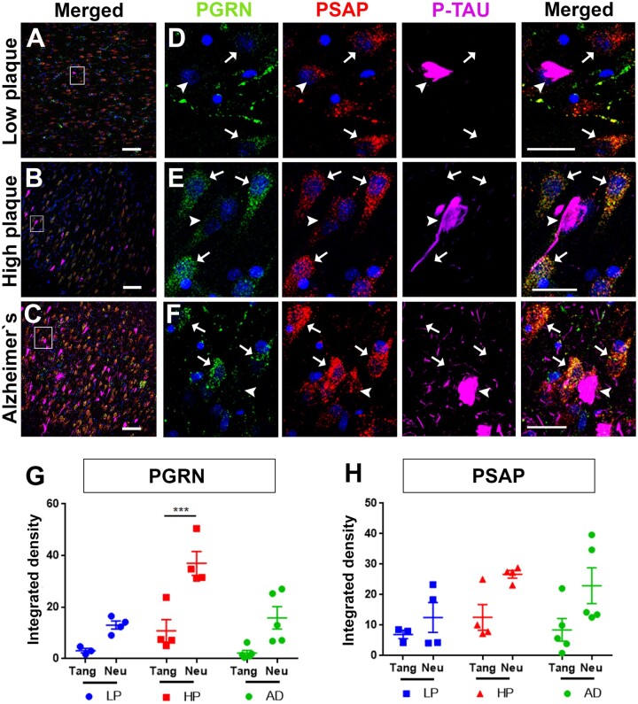 Loss of Lysosomal Proteins Progranulin and Prosaposin Associated with ...