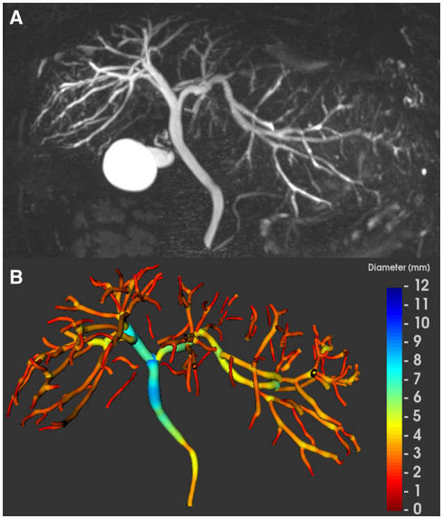 FIG. 1