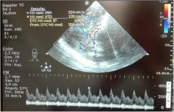 Fig. 1 (abstract P014).