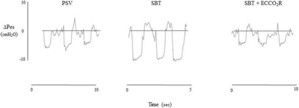 Fig. 1 (abstract P085).