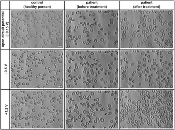 Fig. 1 (abstract P333).