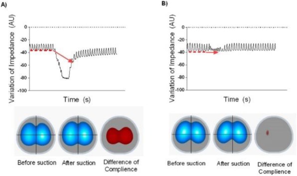 Fig. 1 (abstract P116).