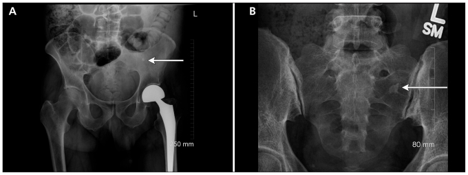 Figure 2: